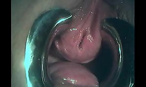BDSM. Labelling girl's urethra